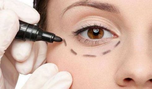 深圳分體式隱形隆鼻醫(yī)院十強(qiáng)榜單揭曉！