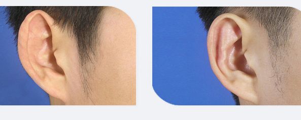 上饒哪家韓式雙眼皮醫(yī)院專業(yè)且值得信賴的推薦？