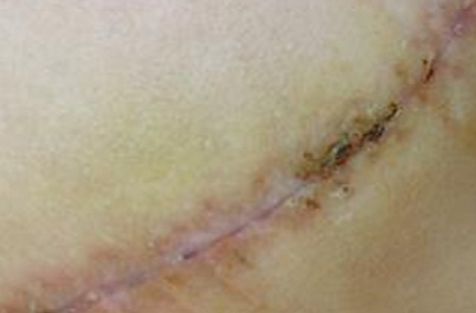 重慶去斑好的醫(yī)院哪家好？權(quán)威推薦，告訴您重慶著名的去斑治療醫(yī)院!