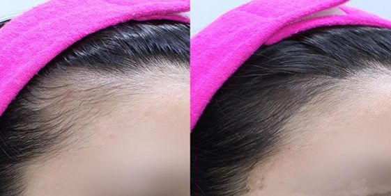 安陽(yáng)民營(yíng)整形醫(yī)院排名前三，哪家效果好的口碑最佳？