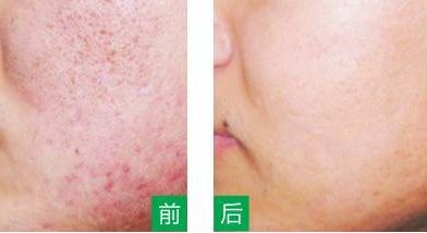 永州美辰醫(yī)療整形醫(yī)院的價格如何？收費標準透明公開，術(shù)前注意事項必看！