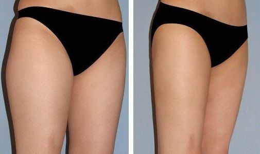 北京好的豐面部醫(yī)院哪家好？口碑最佳推薦！