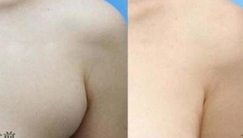 四惠中醫(yī)院植發(fā)技術(shù)之谷遠(yuǎn)飛、王繼萍醫(yī)生介紹及價(jià)格表