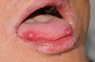 2023六安玻尿酸填充眼角皺紋專家前10位上榜名單(趙遵江、李成虎、夏利娟千萬別錯過！)