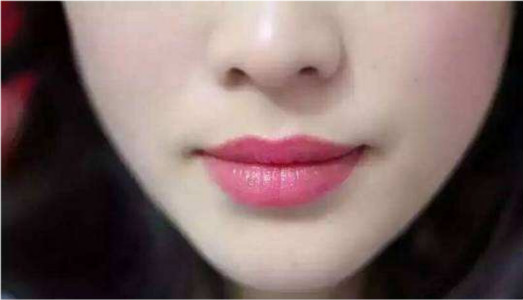 2023東莞膠原蛋白豐耳榜單前十名專家(劉潤貴、馬昌華、王立剛都是正規(guī)好口碑的)