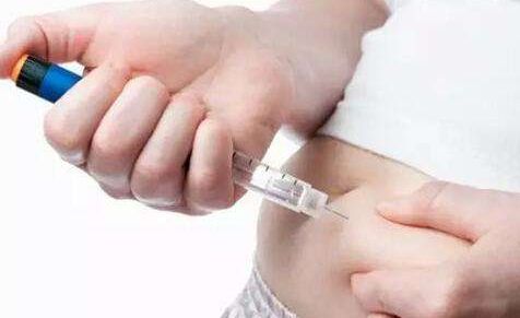 大同做雙眼皮醫(yī)院哪家信譽(yù)好且價(jià)格合理？