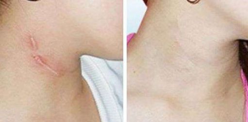 南京整形醫(yī)院哪家好又實(shí)惠？全面評(píng)估南京整容手術(shù)價(jià)格與口碑