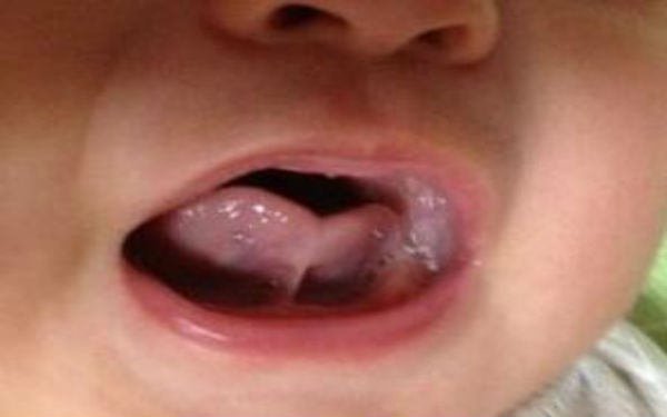 2023廣安光波祛雀斑top10強(qiáng)的醫(yī)生(朱鴷、蔣朝華、蔣朝華真實(shí)口碑橫評(píng)分享)