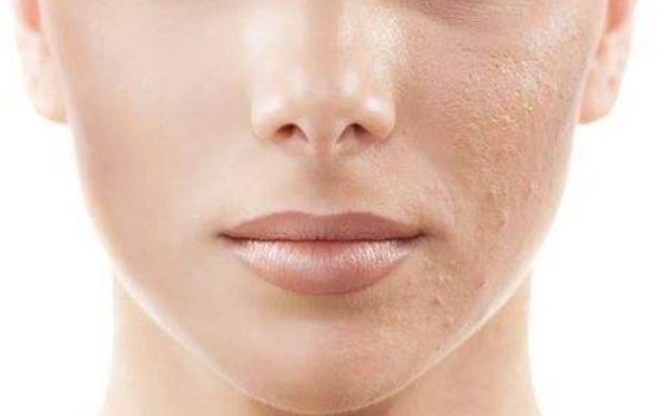 上海柴云做雙眼皮修復(fù)是否靠譜？體驗如何？