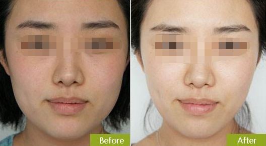 蘇州哪家整形外科醫(yī)院好？快速了解蘇州市頂級整形外科醫(yī)院推薦