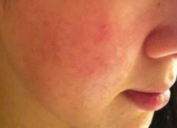 揭秘鄭州五位頗具盛名的鼻子專家，治療技術(shù)獨具匠心，深受人們推崇！