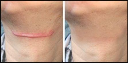 南京哪家私密醫(yī)院做得最好？來一探究竟！