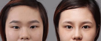 合肥哪家處女膜修復(fù)醫(yī)院靠譜又專業(yè)？