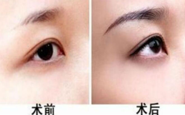 西京醫(yī)院超贊整形醫(yī)生與驚人隆鼻案例，受歡迎至極！