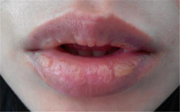 2023蘇州微創(chuàng)印第安紋排行前十位的醫(yī)生(浦彥、丁云莎、單夢琳醫(yī)生大咖實力認證)