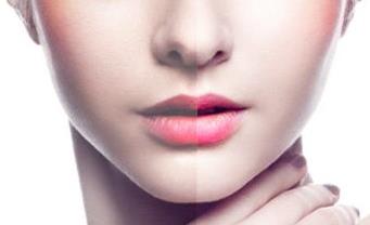 2023南京窈窕假體豐胸醫(yī)生排行top10強(qiáng)(沈干、曹海峰、劉菡被種草)