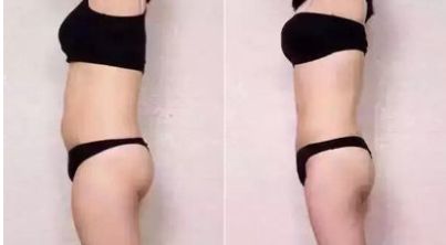 石家莊整容整形醫(yī)院哪家好？全面評(píng)測(cè)幫您選擇最佳醫(yī)療機(jī)構(gòu)！