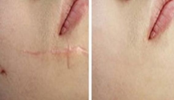 上海有哪些整形醫(yī)院值得推薦呢？