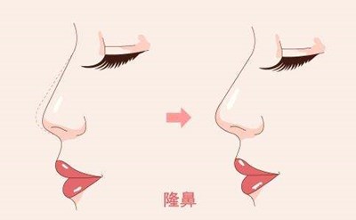 2023重慶膠原蛋白填充面部強(qiáng)榜前10名的專(zhuān)家(陳鵬、楊藝、蔣思軍這幾家技術(shù)高超價(jià)格低)