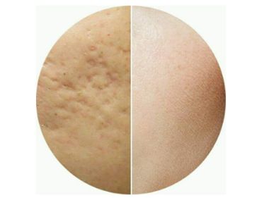 臺州薇閣醫(yī)療美容效果好嗎？李坤醫(yī)生簡介、評價、位置一探究竟