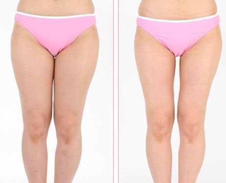 株洲祛痘哪家醫(yī)院靠譜？探尋株洲專業(yè)祛痘醫(yī)療機(jī)構(gòu)！