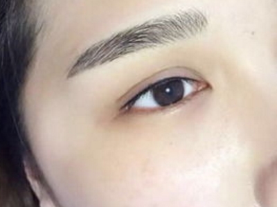 上海華美醫(yī)療美容醫(yī)院最新韓式分層吸脂緊膚術(shù)效果如何？