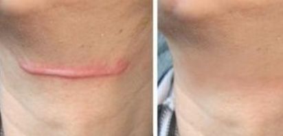 上海哪家醫(yī)院治療皮膚色素斑好？