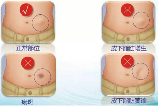 哈爾濱整形醫(yī)院哪家好？選擇哈爾濱整容醫(yī)院前必知的五大關(guān)鍵點