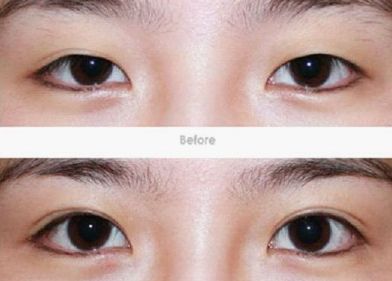 貴陽(yáng)治療疤痕好的醫(yī)院排名及相關(guān)治療方法