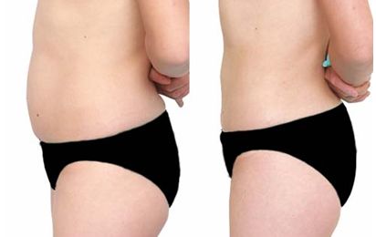 武漢哪家整形醫(yī)院的凸嘴技術好，值得信賴？