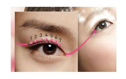 深圳埋線雙眼皮，哪家醫(yī)院技術好，效果持久？