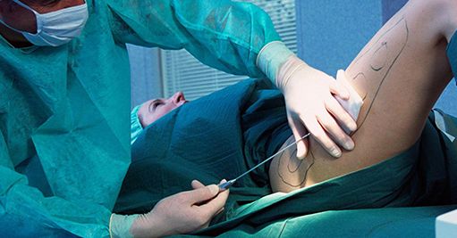 廣州美容整形醫(yī)院哪家好？推薦2023年評(píng)選的廣州頂尖美容整形醫(yī)院