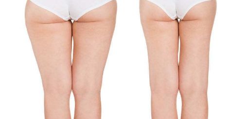 2023年西寧最受推薦的醫(yī)院紅血絲治療服務(wù)是哪家？