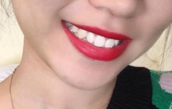 2023南京去除動(dòng)態(tài)細(xì)紋皺紋權(quán)威醫(yī)生排名榜前10強(qiáng)(高俠、左萍、張東獲好評(píng))