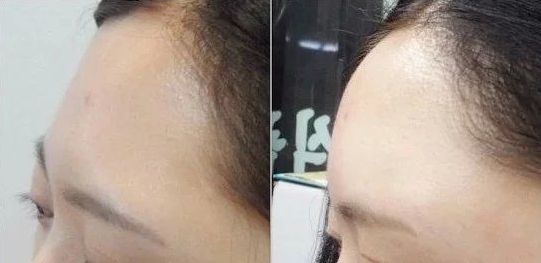 沈陽私密整形去哪家好？專家推薦排行榜2023