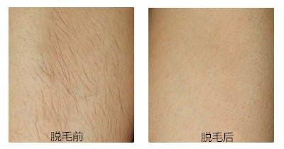 2023濰坊YS立挺鼻整專家排行前幾(王守娟、李書考、王桂芝網(wǎng)友力挺技術強)