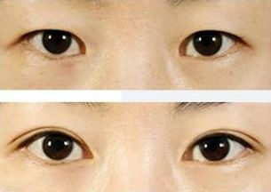 上海治療青春痘的專家推薦，哪家醫(yī)院效果最佳？