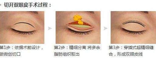 淮安光子嫩膚醫(yī)院哪家好？專家為您推薦5家權(quán)威醫(yī)院