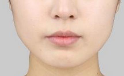 2023杭州祛除痘印口碑排名前10位醫(yī)生(黃良飛、許文澍、宋建良真實(shí)口碑，中肯評價(jià)值得選！)