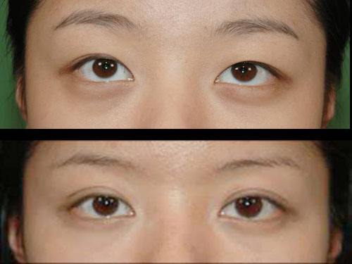 2023武漢冷凍法酒糟鼻治療top10的醫(yī)生(陳佳旭、馬超群、王介聰從實(shí)力看不輸公辦)