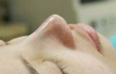 青島哪家眼袋修復(fù)醫(yī)院好推薦？