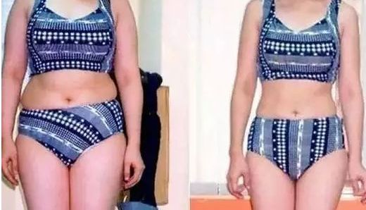 上海哪家醫(yī)院有最有效的黑眼圈去除治療？