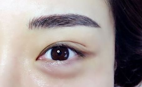 銀川有哪些專業(yè)的激光祛痘印醫(yī)院值得推薦？