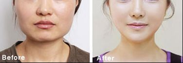 南昌熱瑪吉哪家醫(yī)院做得好？專業(yè)推薦南昌市xx醫(yī)院