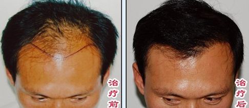 榆林醫(yī)專附屬醫(yī)院醫(yī)學(xué)整形美容中心怎么樣？榆林醫(yī)專附屬醫(yī)院醫(yī)學(xué)整形美容中心簡介|醫(yī)生團(tuán)隊(duì)|口碑評價(jià)！