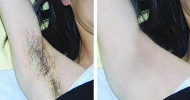 成都整下巴哪家醫(yī)院好，專家助你實(shí)現(xiàn)完美下巴線條