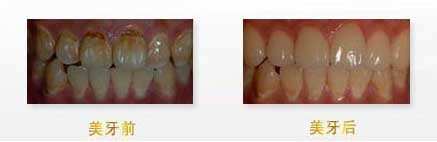 揭秘：武漢眼科醫(yī)生，他們的技術(shù)無人能敵！