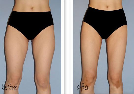 福州哪家整形醫(yī)院做下巴好？多年經(jīng)驗(yàn)專業(yè)醫(yī)生為您解答！