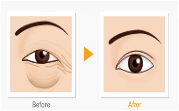 哈爾濱隆胸修復(fù)醫(yī)院排名及口碑對(duì)比，哪家專(zhuān)業(yè)又靠譜？