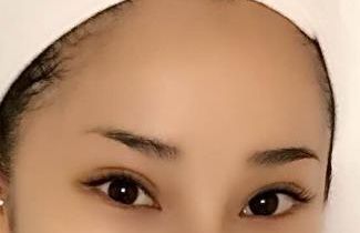 合肥哪家醫(yī)院臉部激光治療效果好，值得推薦？